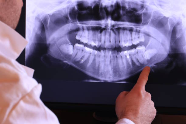 Best Emergency Treatment for Oral Infections in Troy, MO